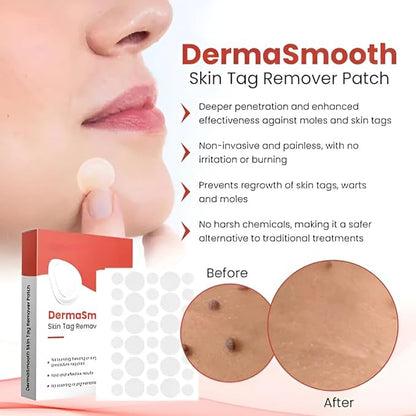 Derma Smooth Skin Tag Removal Patch Kashio Fast Acting Painless Skin Tag and Mole Remover Patch Natural Formula for Clear Smooth Skin Safe for All Skin Types